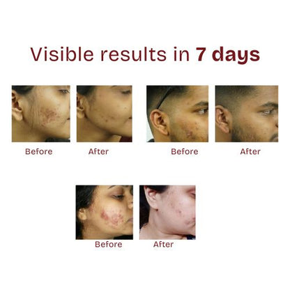 Kumkumadi Thailam - 10mL